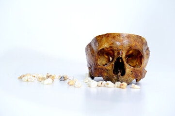 Educational model with post of dental implant between teeth and crowns on table indoors. Dental...