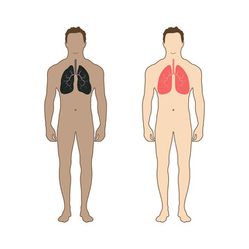 A person with healthy lungs and sick lungs. Flat style. 