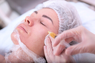 Cosmetologist makes injections of plasmolifting for the face. Plasmolifting procedure. Blood in a...