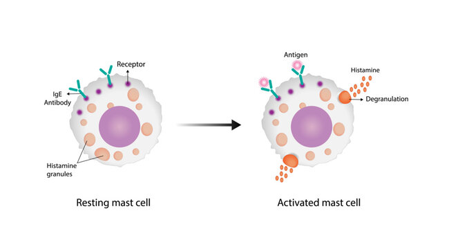 Resting and activated mast cell. Anaphylactic, allergic reaction, Autoimmune disorders, allergy and anaphylaxis. IgE antibodies are in involved in Anaphylactic reaction. Vector illustration.