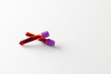 Two blood sample tubes with purple lids, on white background with copy space