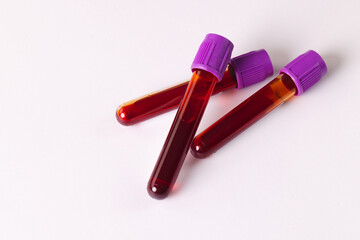 Three blood sample tubes with purple lids, on white background