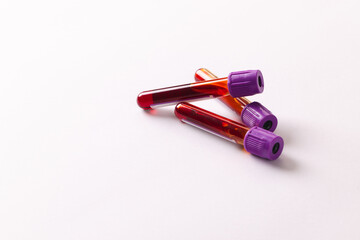 Three blood sample tubes with purple lids, on white background with copy space