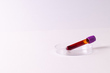 Blood sample tube in petri dish, on white background with copy space
