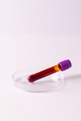 Blood sample tube in petri dish, on white background with copy space