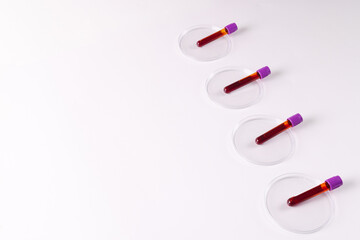 Row of blood sample tubes in petri dishes, on white background with copy space