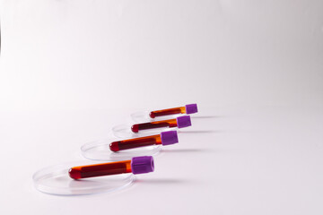 Row of blood sample tubes in petri dishes, on white background with copy space