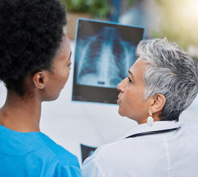 X Ray, Senior Woman Analysis And Doctor Team With Conversation And Medical Collaboration. Healthcare, Clinic And Hospital Worker With An Xray Doing Problem Solving With Professional Assessment