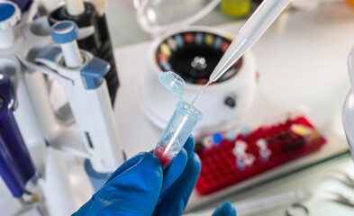 Police scientist analyzes bloody evidence in vial to discover the identity of suspect's DNA,...