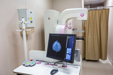 Mammography test at the hospital. Medical equipment. Mammography breast screening device in...