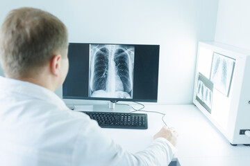 doctor studying x-ray on computer