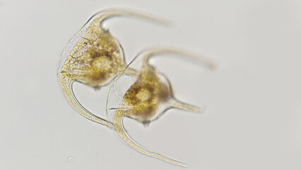 Ceratium tripos, a marine phytoplankton belonging dinoflagellata group. Lugol preserved sample. 400x magnification