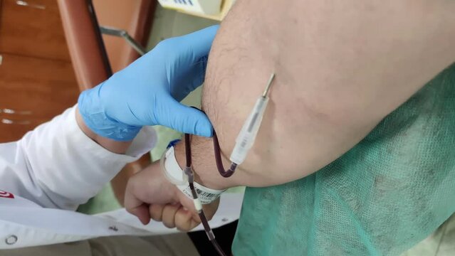 the moment of inserting the needle into the vein of the hand in order to donate blood by an honorary blood donor.