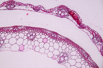 Host cells with spores (mold) are inside wood under the microscope for education.	