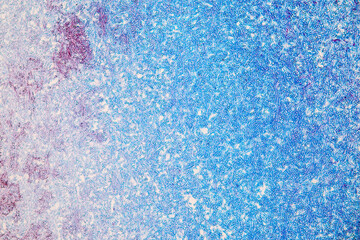 Host cells with spores (mold) are inside wood under the microscope for education.	