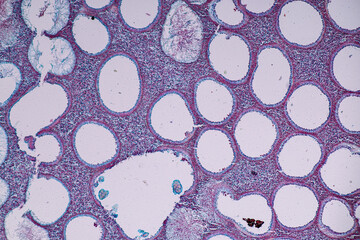 Host cells with spores (mold) are inside wood under the microscope for education.	