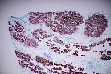 Host cells with spores (mold) are inside wood under the microscope for education.	