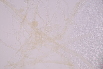 Host cells with spores (mold) are inside wood under the microscope for education.	