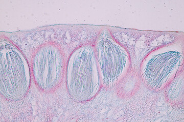 Host cells with spores (mold) are inside wood under the microscope for education.	
