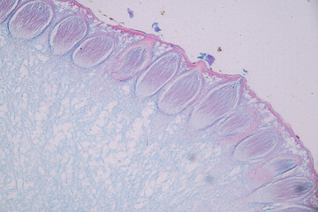 Host cells with spores (mold) are inside wood under the microscope for education.	