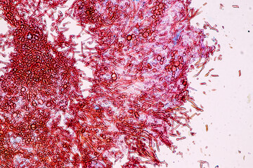 Host cells with spores (mold) are inside wood under the microscope for education.	
