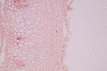 Fototapeta premium Host cells with spores (mold) are inside wood under the microscope for education. 