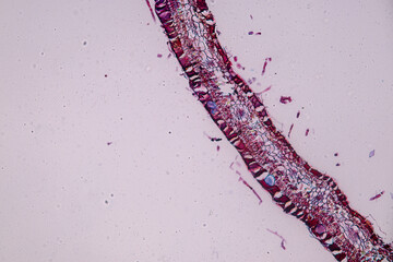 Host cells with spores (mold) are inside wood under the microscope for education.	