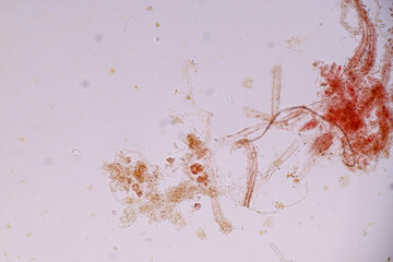 Host cells with spores (mold) are inside wood under the microscope for education.	