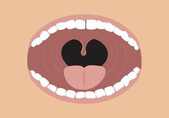 Opened Mouth concept with tonsils shown. Editable Clip art.