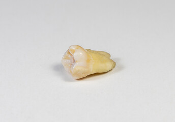 A close-up of a jaw tooth on a white background