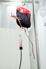A bag of blood hanging from a pole. Blood is transferred to a cesarean section patient in a...