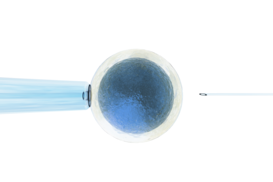 Intracytoplasmic sperm injection and human egg over white background