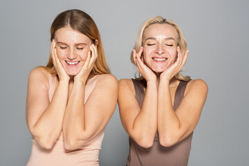 Smiling interracial women with problem skin touching face isolated on grey.