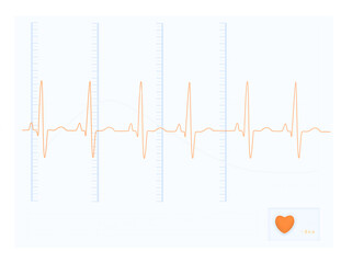 Digitally generated image of electrocardiography