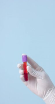 Vertical video of hand wearing medical glove holding blood sample on blue background, slow motion