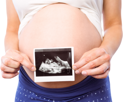 Pregnant woman showing ultrasound scans