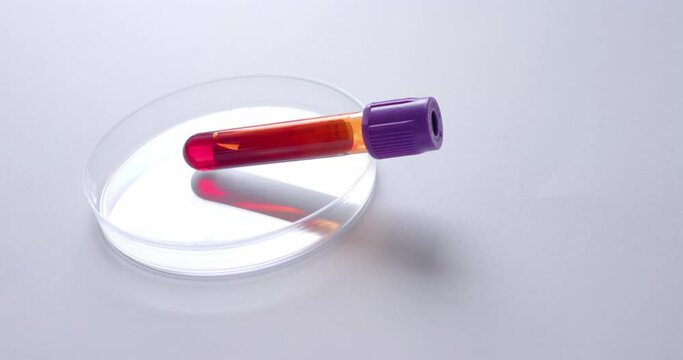 Close up of blood sample and petri dish on white background with copy space, slow motion