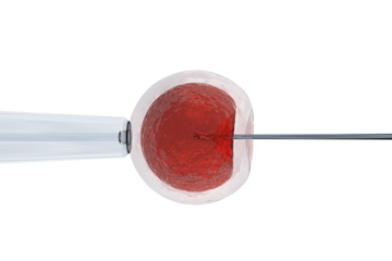 Illustration of intracytoplasmic sperm injection