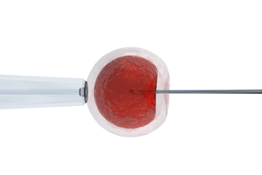Illustration of intracytoplasmic sperm injection