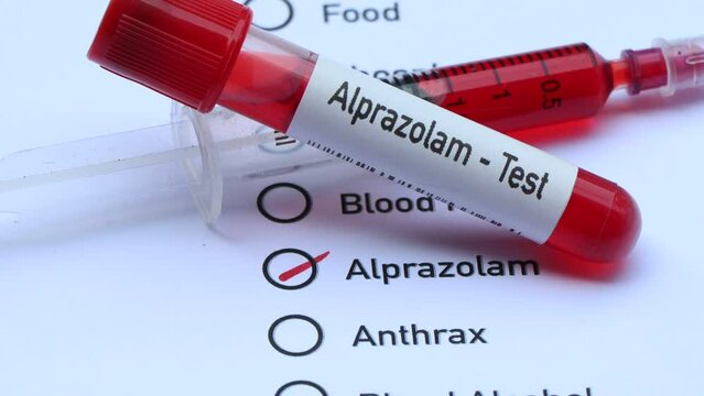 Alprazolam test to look for abnormalities from blood,  blood sample to analyze in the laboratory, blood in test tube