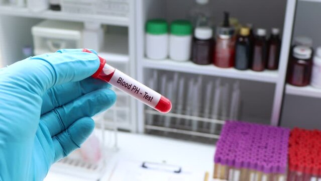 Blood pH test to look for abnormalities from blood,  blood sample to analyze in the laboratory, blood in test tube