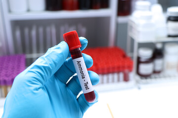 Ammonia test to look for abnormalities from blood