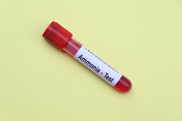 Ammonia test to look for abnormalities from blood