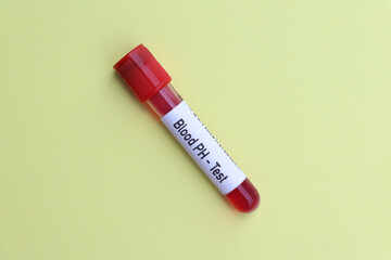Blood pH test to look for abnormalities from blood