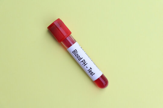 Blood pH test to look for abnormalities from blood