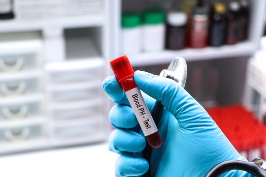 Blood pH test to look for abnormalities from blood