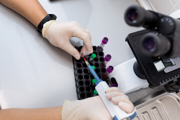 Technician holding blood tube test in the research laboratory