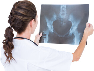 Rear view of female doctor looking at an X-ray
