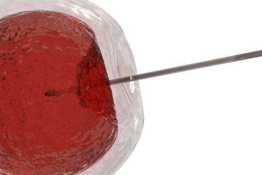 Intracytoplasmic sperm injection