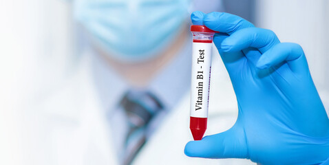 Doctor holding a test blood sample tube with Vitamin B1 test.
